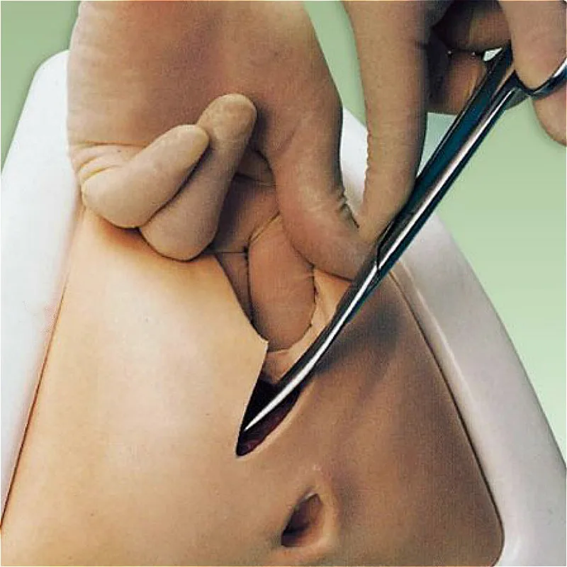 Перинеотомия и эпизиотомия презентация