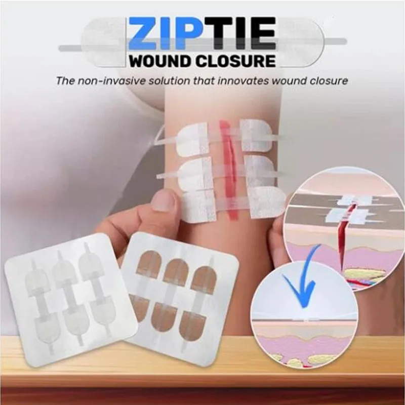 Zip Tie Wound Closure Patch BandAid Hemostatic Adhesive Aid Emergency