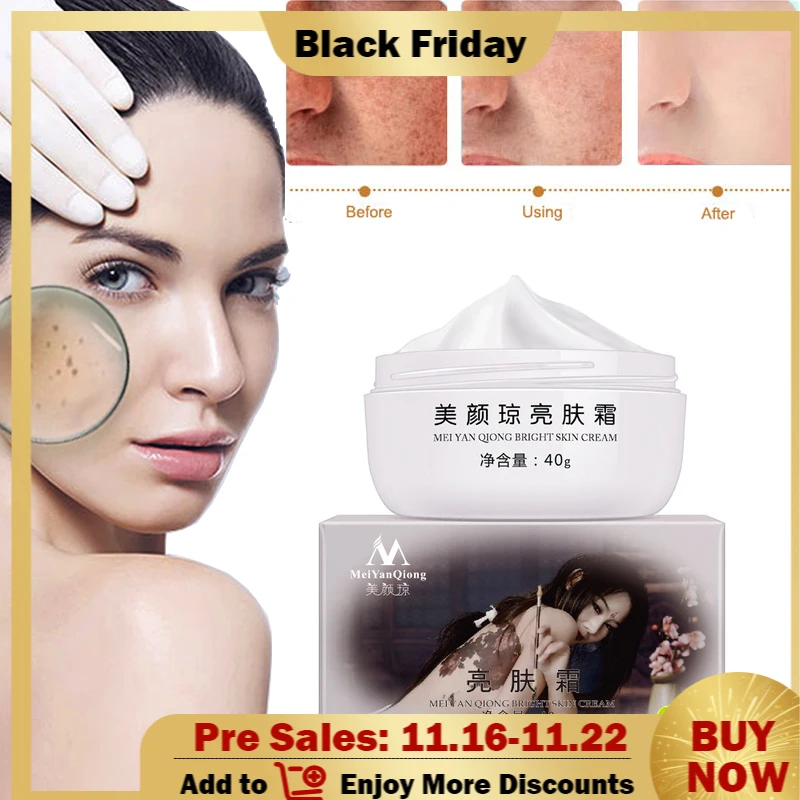 

Strong Effects Whitening Cream 40g Remove Melasma Acne Spots Pigment Melanin Sunburn Pregnancy Spots Face Care Cream