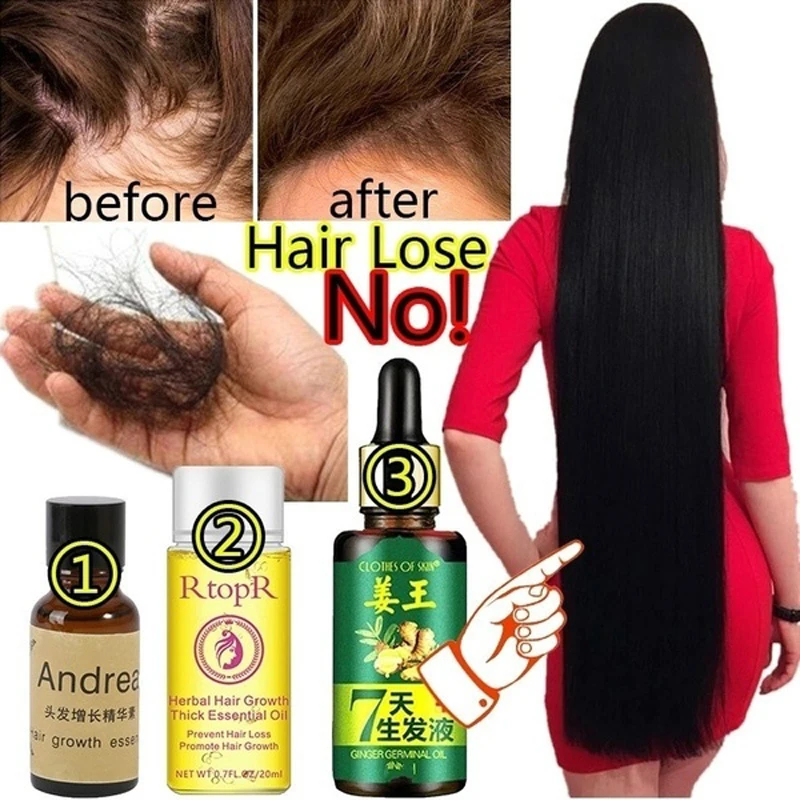 Esencia para el crecimiento del cabello de jengibre, 30/20/10 ML, 7 días de suero para el crecimiento del cabello Germinal, aceite esencial para evitar la pérdida de cabello y daños