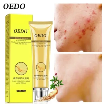

OEDO Ginseng Acne Removal Cream Acne Treatment Gel Oil Control Remove Pimples Shrink Pores Fade Marks Scar Facial Skin Care 20g