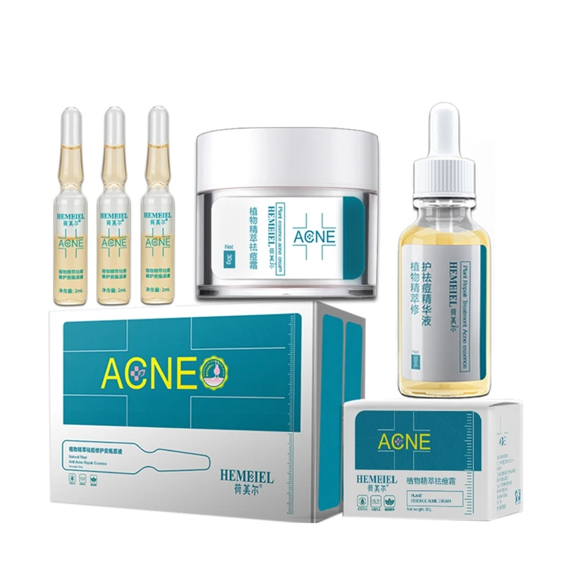 acne treatment set