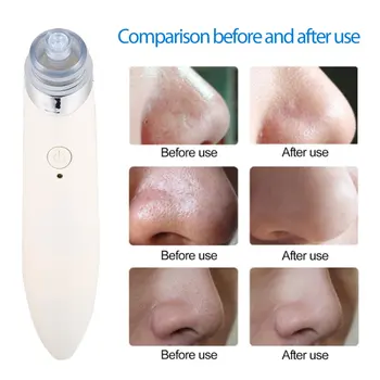 

Vacuum Negative Pressure Type Acne Pore Cleaning Instrument Beauty Skin Care Specialist with Strong Adsorption
