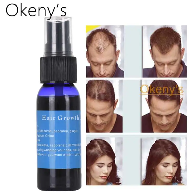 Okeny's Yuda Pilatory продукты для быстрого роста волос лечение от выпадения волос, шампунь для женщин и мужчин густой китайский рецепт