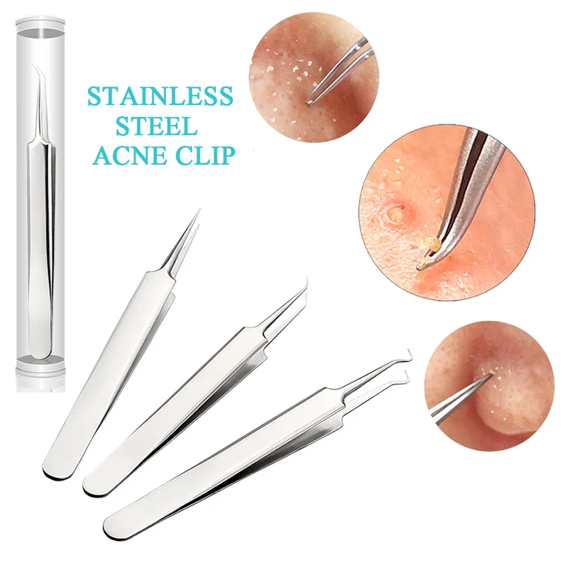 

1 Pc Blackhead Comedone Pimple Acne Extractor Remover Tool Blackheads Pimples Remover Tool Spoon for Face Cleaning