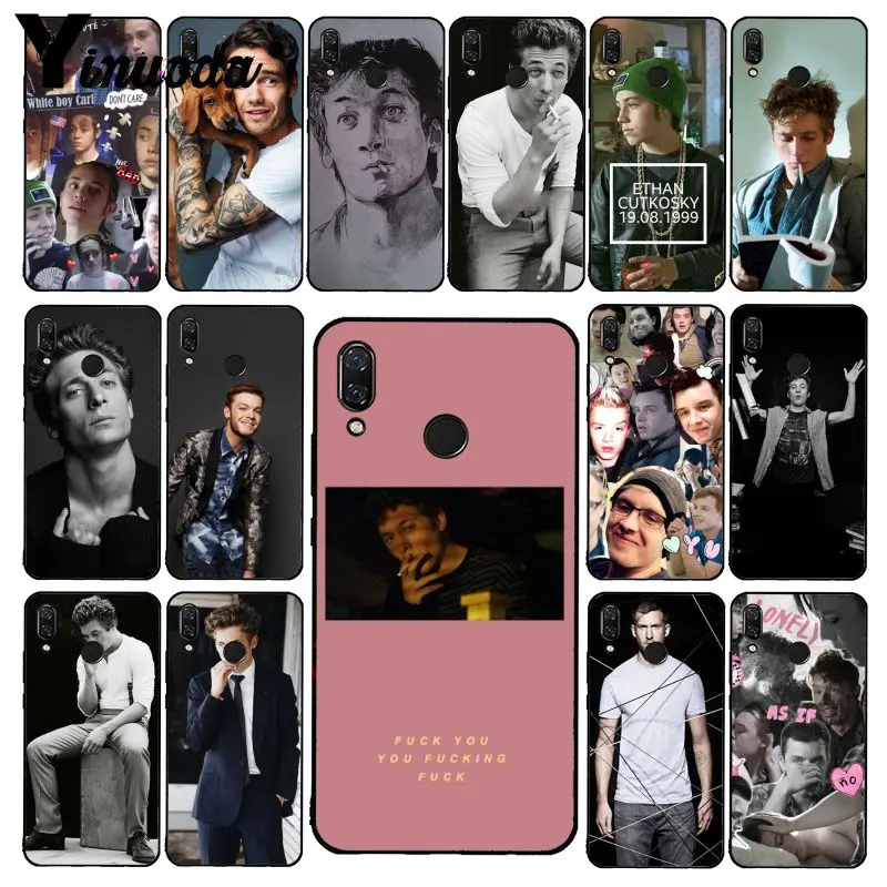 

Yinuoda Lip Gallagher Shameless tv show Phone Case for Xiaomi Redmi Note 7 5 4 Redmi 5plus 6A Note8 4X Note8Pro