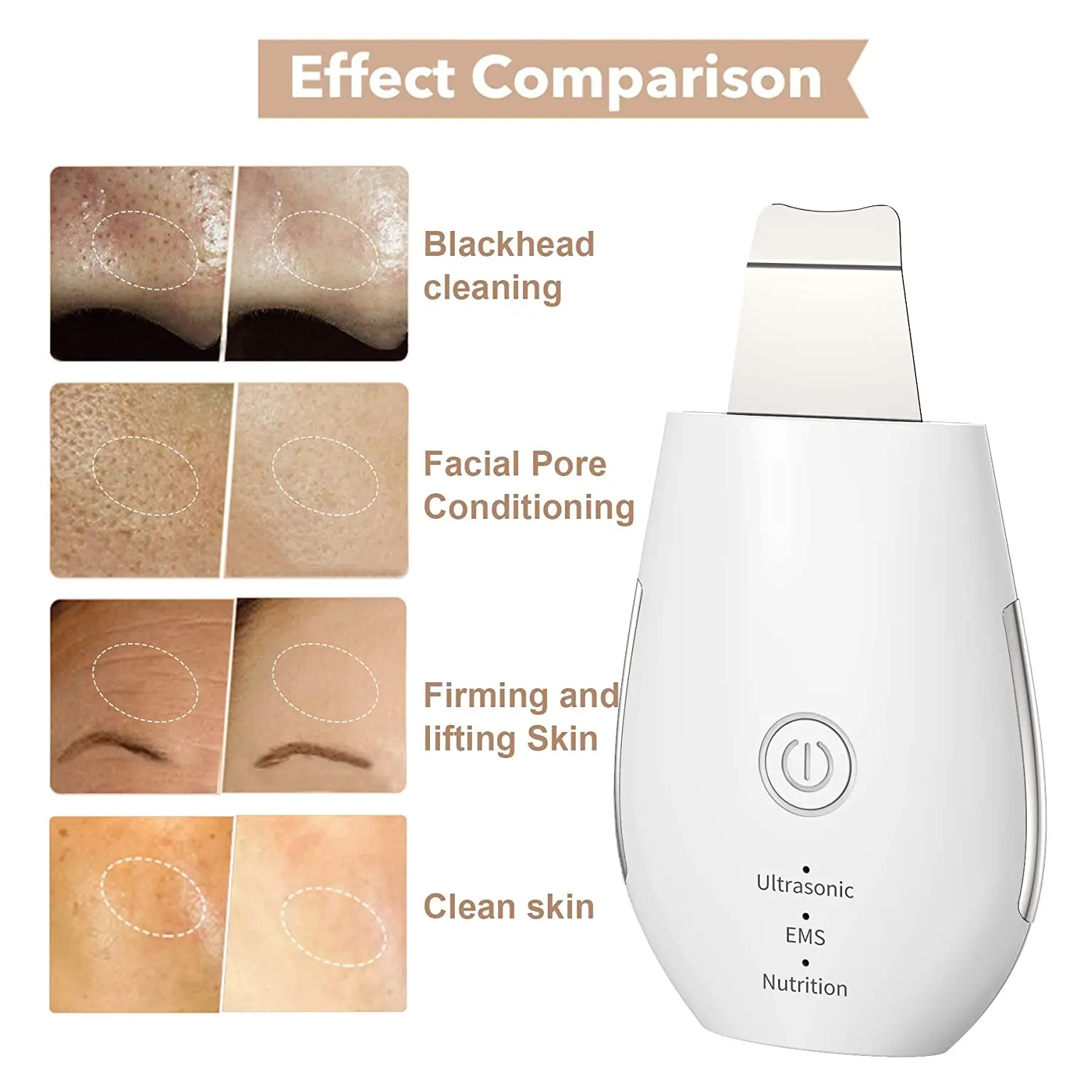 Skin Scrubber Facial Ultrasonic Cleaner Blackhead Remover Extractor Exfoliator Face Lifting Tool with 3 Modes For Deep Cleansing