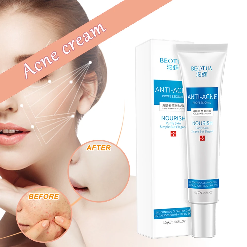 

Blemish Cream Spots Removal Treatment Pimple Ointment Scar Mark
