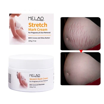 

Thailand maternity stretch marks cream scars removal powerful postpartum obesity pregnancy scar removal body cream 06