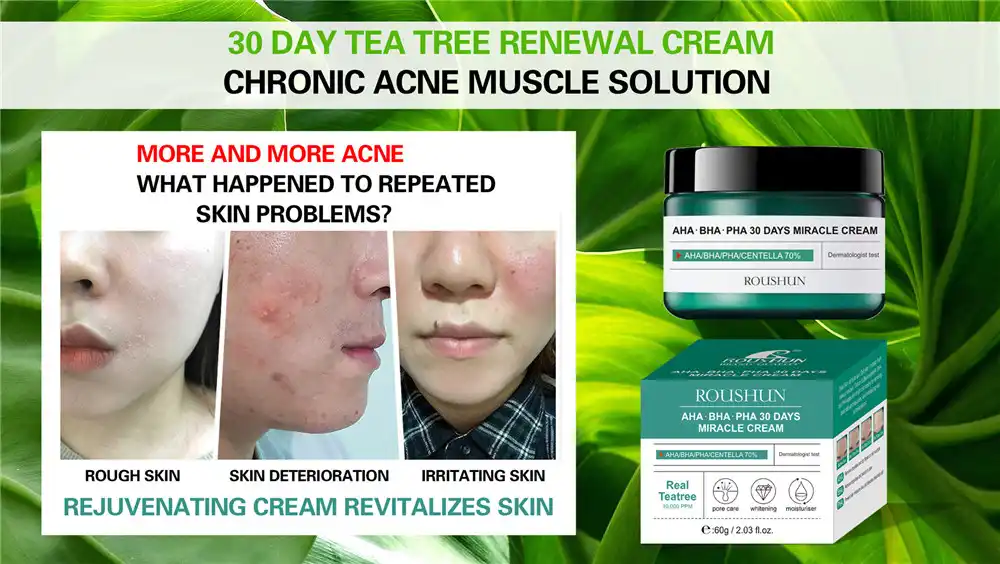 aha cream for acne scars