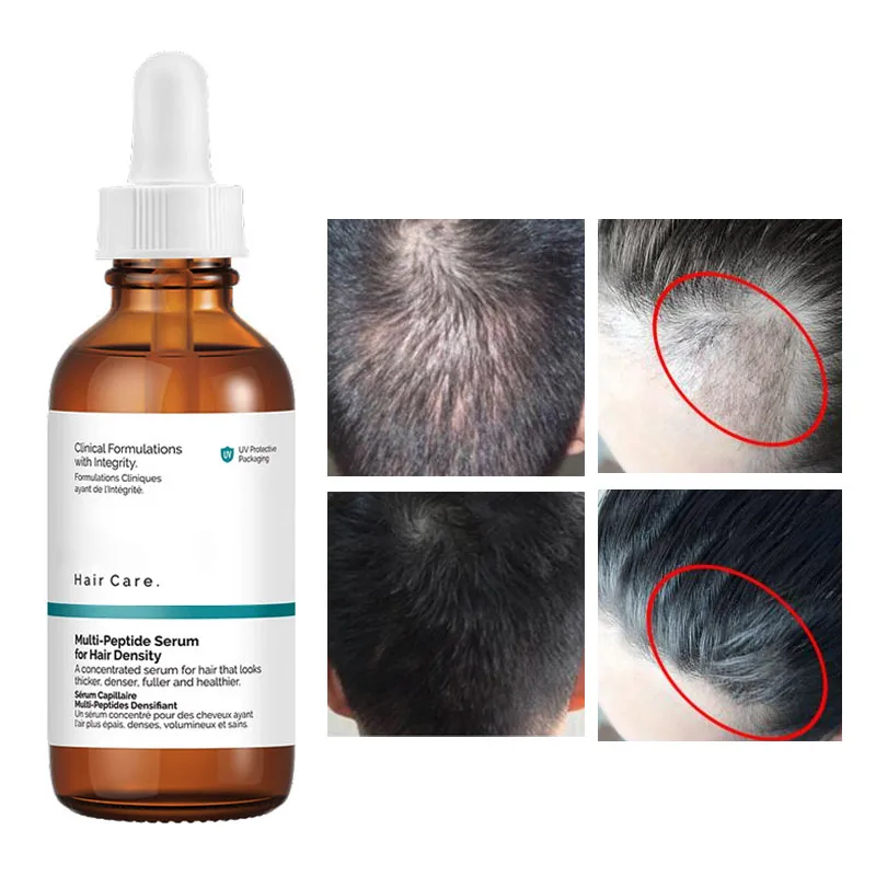 the ordinary multi-peptide serum for hair density