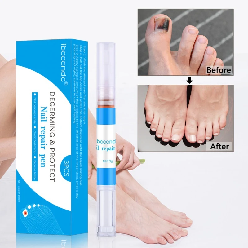 Limited Price for  3pcs Effective Nail Care Solution Repair Nails Inhibition Of Fungal Infections Toenail Fungus Treat