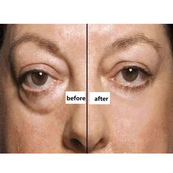 

Ageless Anti aging anti wrinkle cream lifted serum Puffy Eyes Eliminate Eye Bags reduce fine lines Dark circles