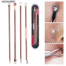 4 шт., розовое золото, инструмент для удаления черных точек, экстрактор акне, черное средство для удаления пятен, набор, средство для очищения пор, средство для удаления пятен