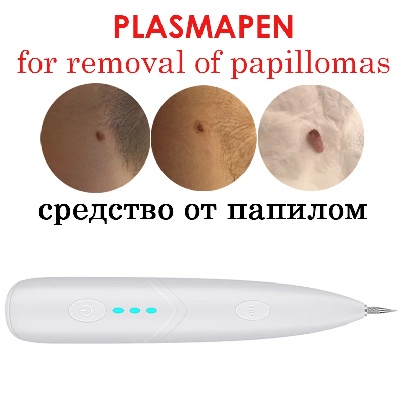 Plasma Pen Plazma Polka Dot Meat Mole Remover Plazmapen for Removal Papillomas Warts Plasmapen Apparatus from Black Spot Cleaner