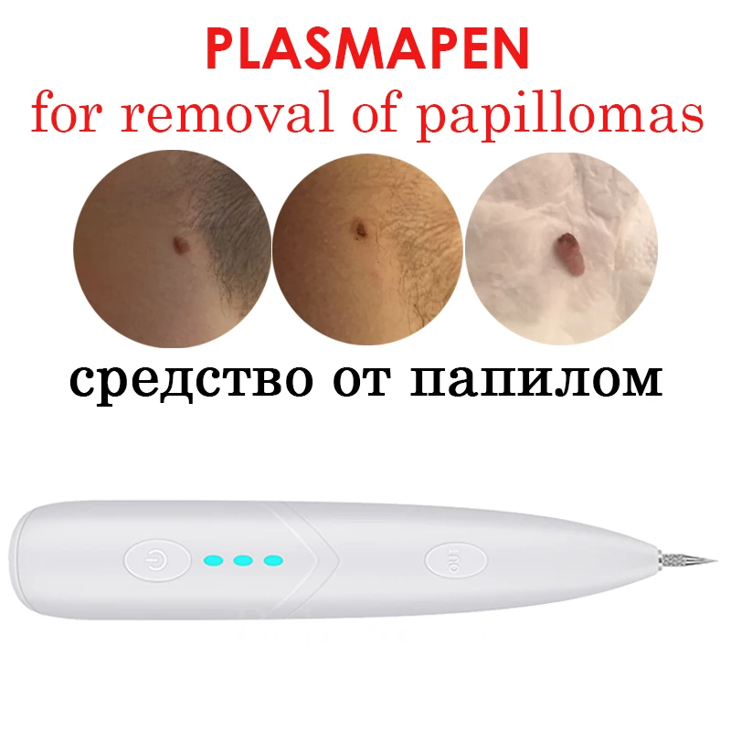 Plasma Pen Plazma Polka Dot Meat Mole Remover Plazmapen for Removal Papillomas Warts Plasmapen Apparatus from Black Spot Cleaner 100 pcs korean version of fresh meat pot gel pen simple fresh plant black water pen student stationery kawaii school supplies