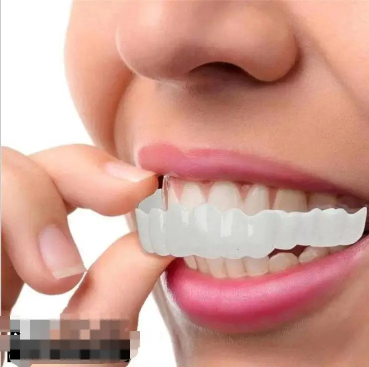 upper & lower teeth braces set Perfect Smile Veneers Comfort Flex