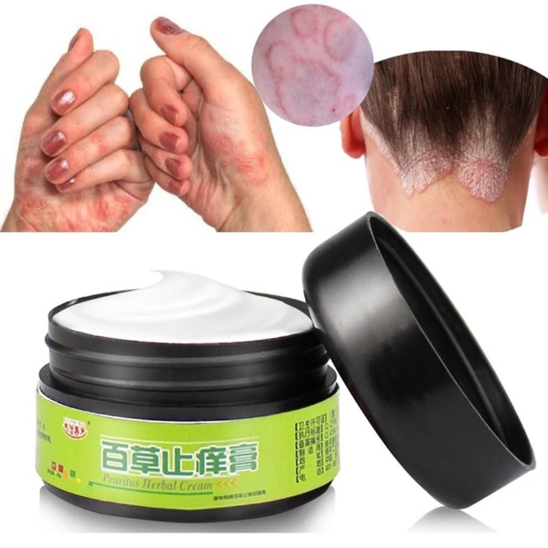 

25g Natural Herbal Ointment Psoriasi Cream Effective for Dermatitis Psoriasis Eczema Cream Chinese Herbal Medicine R6