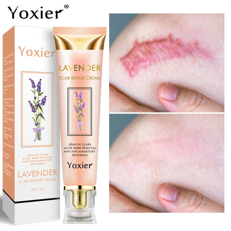 Lavender Scar Repair Cream Removal Burn Scars Promote Cell Regeneration Acne Treatment Remove Stretch Mark Smooth Skin Care | Красота и