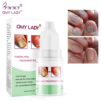 

Fashion High Quality Nail Protector Skin Care ESSENCE Cream Nail Fungus Treatment Nails Repairing Cream Nail Care Tools TSLM1