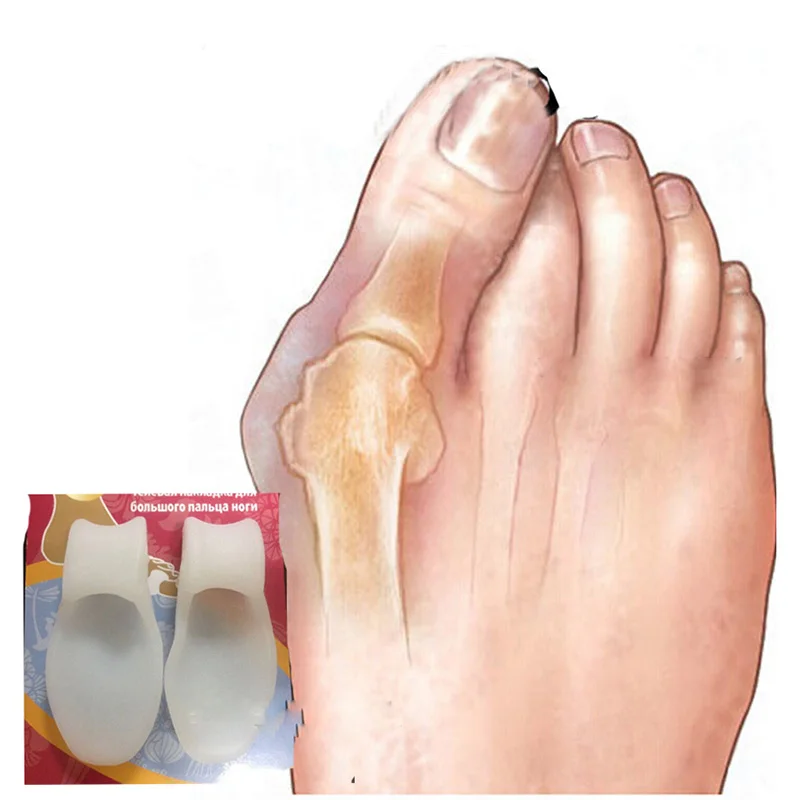 Silicone-Gel-Foot-Toe-Separator-Thumb-Hallux-Valgus-Corrector-Orthopaedic-Foot-Protector-Bunion-Adjuster-Feet-Care (1)