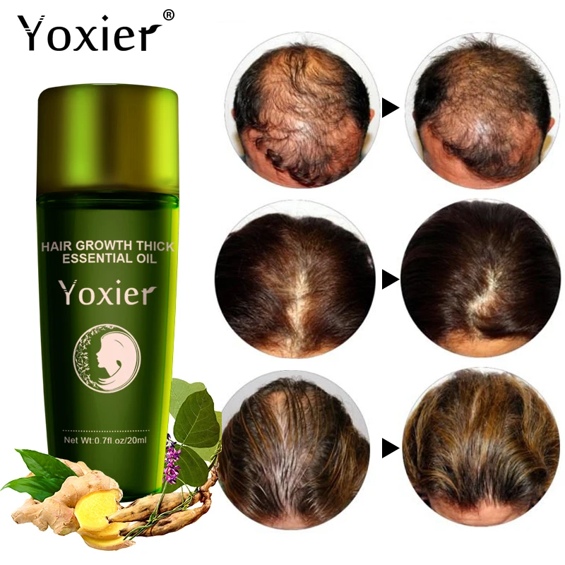 Yoxier New Hair Growth Essence Oil Effective Extract Anti Nourish Hair Roots Treatment Preventing Hair Loss 3