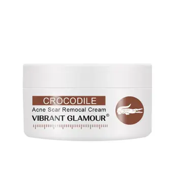 

Whitening Face Cream Stretch Mark Treatment Skin Care Cream 30g Crocodile Repair Acne Scar