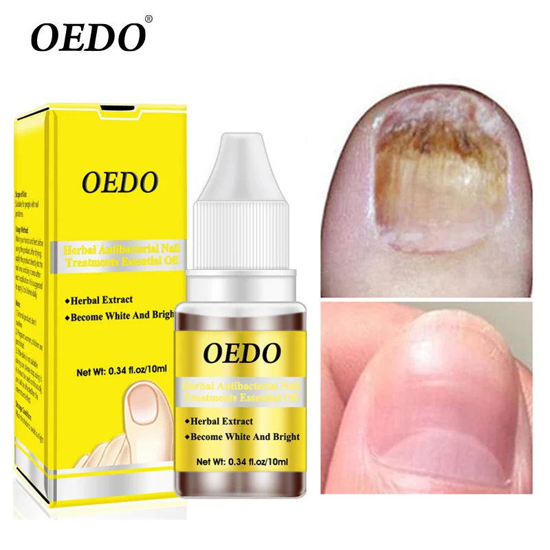 

OEDO Fungal Nail Repair Essence Toe Nail Fungus Treatment Serum Nails Gel Paronychia Onychomycosis Anti Infection Nails Care