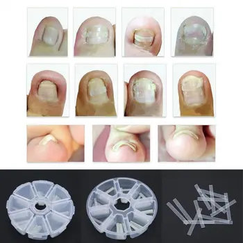 

120pcs/box Ingrown Toenail Correction Straightening Clip Toe Nail Sticker Patch Correction Pedicure Foot Care Tool