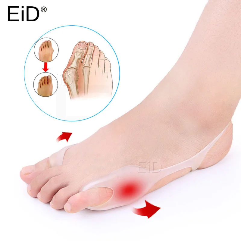 EiD 2 шт Sinlicone Hallux разделитель пальцев при вальгусной деформации силиконовые стельки носок бандаж на палец выравнивание прибор палец болеутоляющее вставка