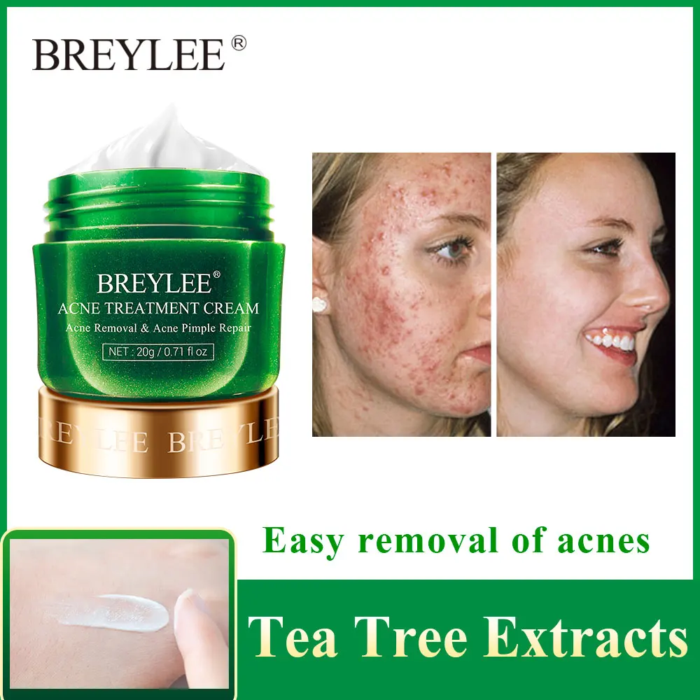 BREYLEE Acne Treatment Cream Anti Acne Face Cream Remove Pimple Spots Oil Control Shrink Pores Smoothing Skin Care Tea Tree 20g afbeelding