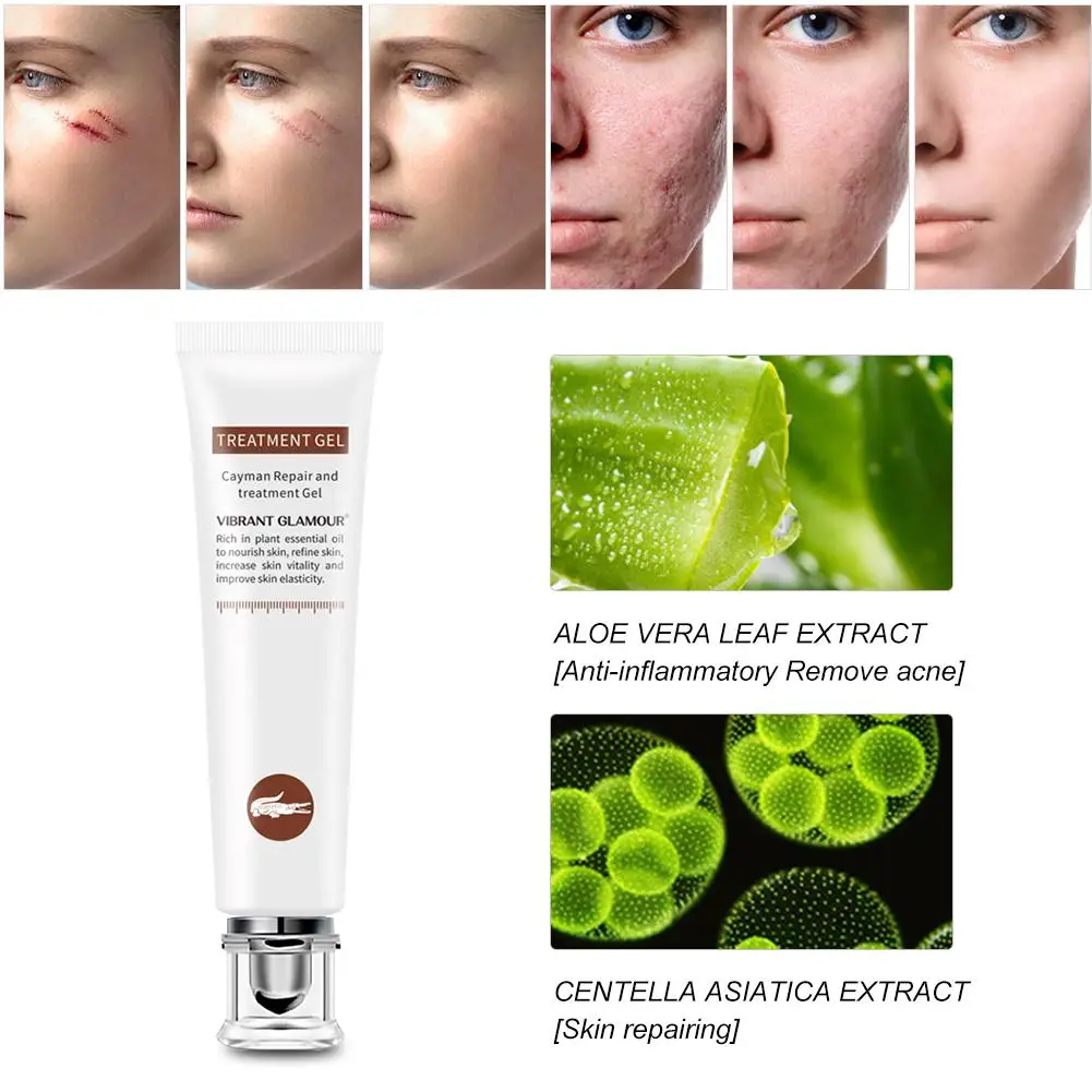 Scar Removal Cream Gel For Face Acne Scar Stretch Marks Remover Cream Skin Repair Face Cream For Burns Dilute Scars Skin