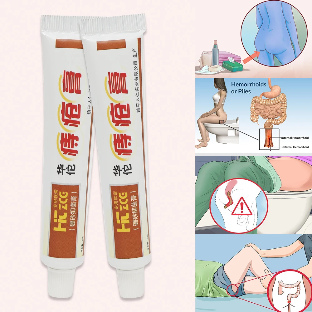 Hua Tuo Hemorrhoids Ointment Chinese Herbal Hemorrhoids Cream External Anal Fissure Medical Plaster Health Care Pain Relief