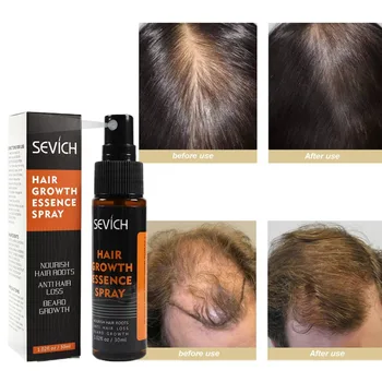 

Hair Growth Essence Essential Oil Liquid Spray Nourish Roots Thick Shiny Prevent Hair Loss Anti-hair FE64