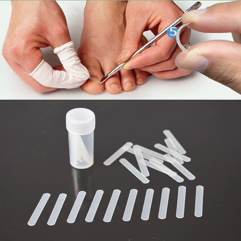 

Professional Ingrown Toenail Correction Pedicure Tool Ingrown Toe Nail Treatment Elastic Patch Sticker Straightening Clip Brace