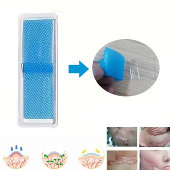 

Silicone Removal Patch Reusable Acne Gel Scar Therapy Silicon Patch Remove Trauma Burn Sheet Skin Repair