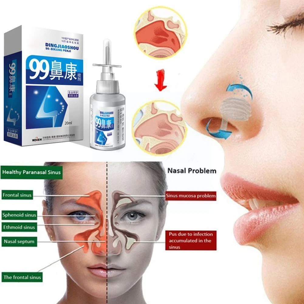 Nasal Sprays Chronic Rhinitis Sinusitis Sprays Nose Care Chinese Traditional Medical Herb Spray