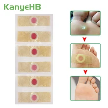 24pcs Medical Plasters Foot Corn Removal Warts Thorn Patch Curative Patches Calluses Callosity Detox Foot Pads Toe Patch A174