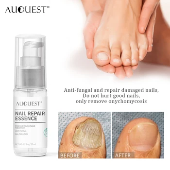 

AUQUEST 20ml Nail Repair Essence Serum Foot Nail Fungus Remedy Treatment Anti Infection Paronychia Onychomycosi Hand Foot Care