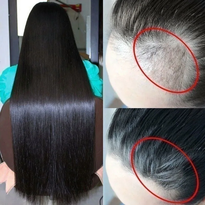Effective Hair Growth Products Fast Thick for Hair Prevent Hair Loss Damaged Hair Repair Natural Hair Care Products