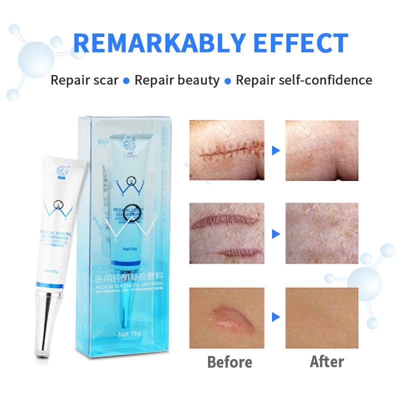 Scar Removal Safe Effective Medical Silicone Acne Scars Gel Flatten Repair Burn C-Section Keloid Scars Treatment Face Body