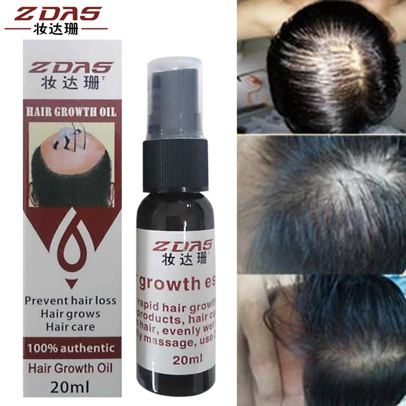 HTB1JV1fXtknBKNjSZKPq6x6OFXax