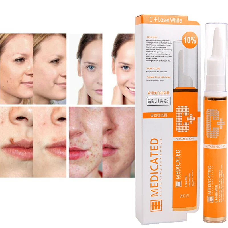 15ML Freckle Remover Gel Vitamin C Whitening Anti-Freckle Cream Pencil to effectively remove stains and freckles 15ML Freckle Remover Gel Vitamin C Whitening Anti-Freckle Cream Pencil to effectively remove stains and freckles