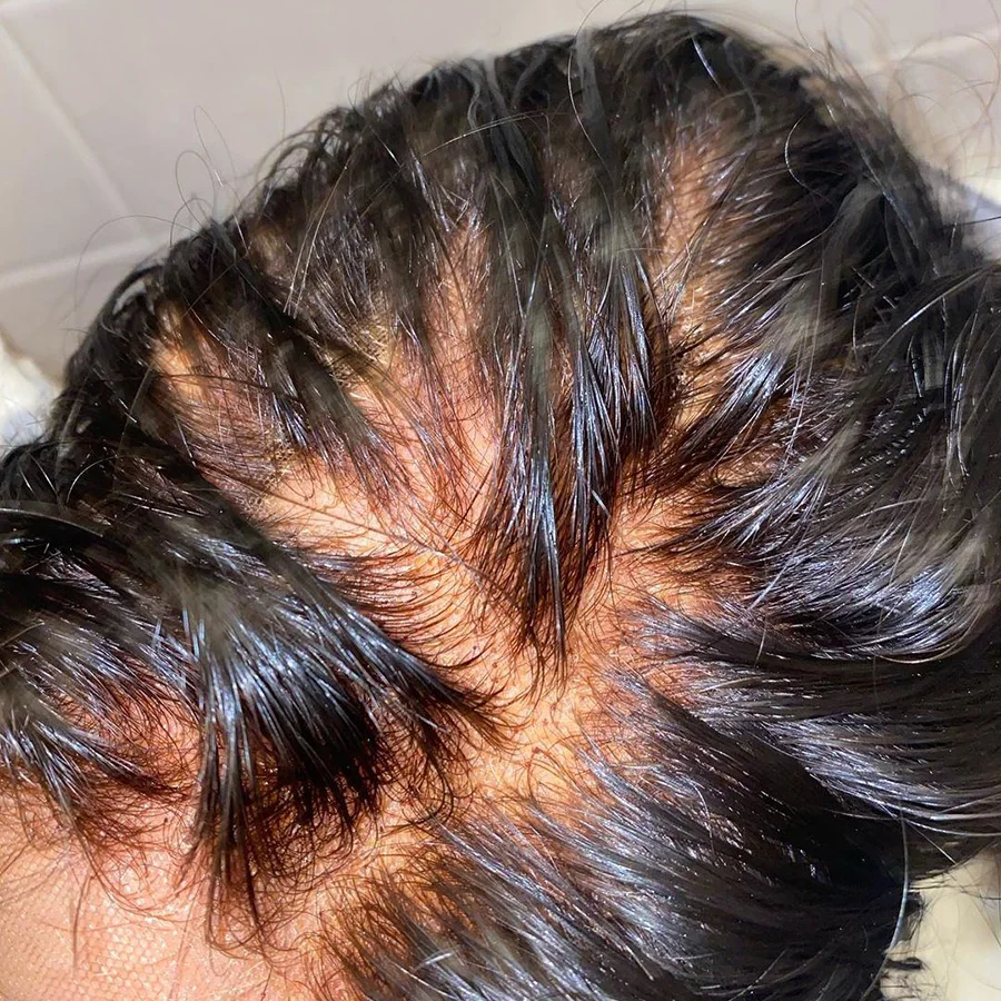 Invisível da Onda do Corpo Cabelo do Bebê Remy do Cabelo Peles do Derretimento do Laço 13*4 do Laço do Fechamento do Laço de hd com o Cabelo Fechamento Frontal Bebê Humano hd Renda Transparente do 2 Apliques e perucas