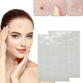 

OEM Acne Pimple Patch Invisible Acne Stickers Blemish Treatment Acne Master Pimple Remover Beauty Tool Skin Care