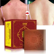 Тибетское мыло ручной работы увлажняющее масло-контроль против клещей анти Очищение акне мыло эффективное уход за лицом Pro