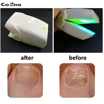 

Lllt Cold Level Laser Therapy Device For Toe Nails Fungus Remove Hand Nails Fungus Treatment No Pain Rechargeable 905nm CE