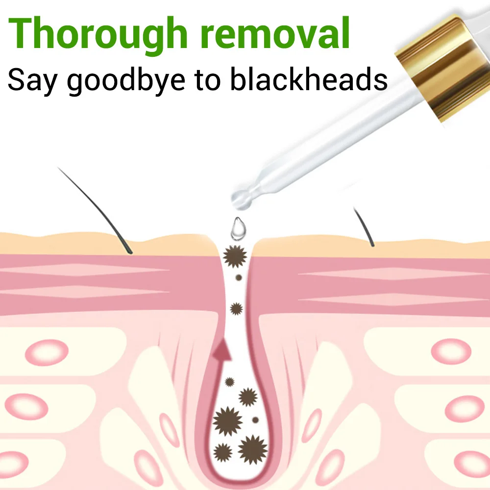 Сыворотка LAMBENA для удаления черных точек на лице сыворотка против прыщей сужает