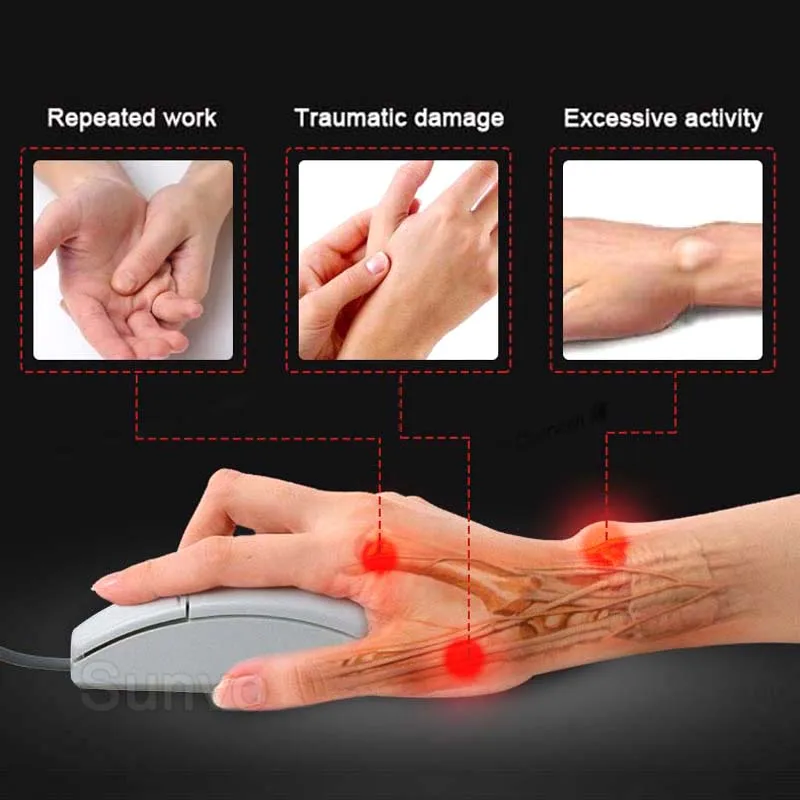 Tendon Sheath Patches 10pcs for Tenosynovitis Arthritis Pain Relief