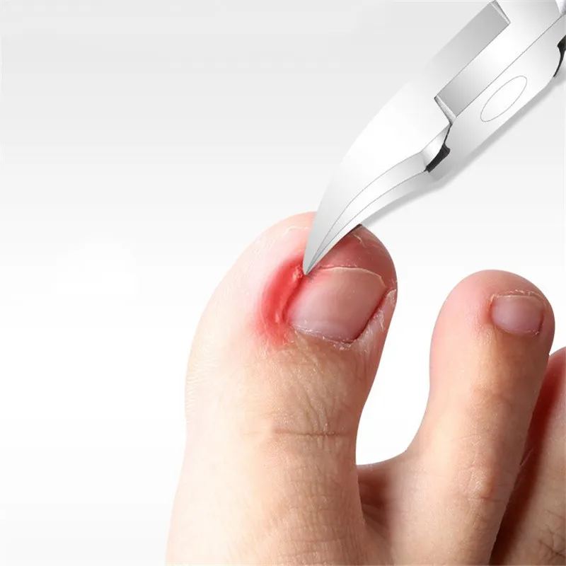 Cuticle Remover Kit Nail Clipper Trimmer for Cuticle Ingrown Nails Pedicure & Manicure Corrector Fixer Foot Care Tool